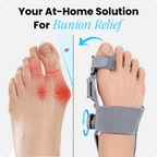At-Home Solution For Bunion Relief
