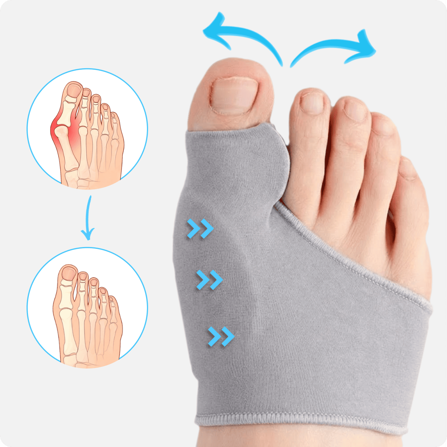 Curalis™ Daytime Bunion Sleeve