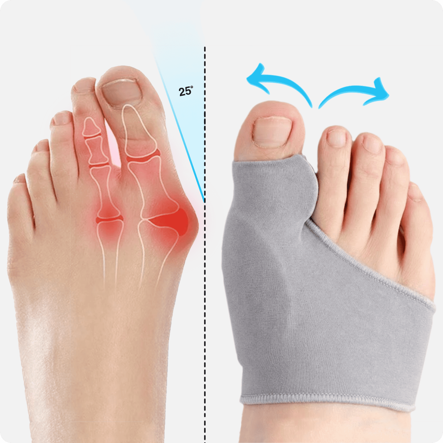 Curalis™ Daytime Bunion Sleeve